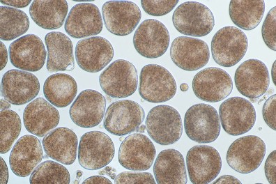 Moule (Mytilus edulis) - Ovules juste après leur émission par une femelle x25